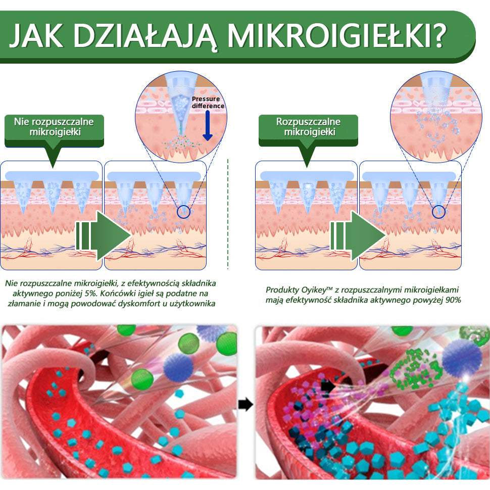 Voilaist® SMGT-GLP-1 Nano Microneedle Patch(⚡Bezbolesny, długotrwały, zwalczający cukrzycę, otyłość i choroby układu krążenia)