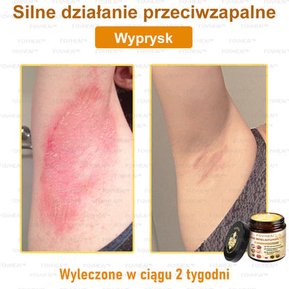 ✨FOVHEAl™ Krem z Jadem Pszczelim – Wygładza zmarszczki i przywraca młody wygląd – 50 ml