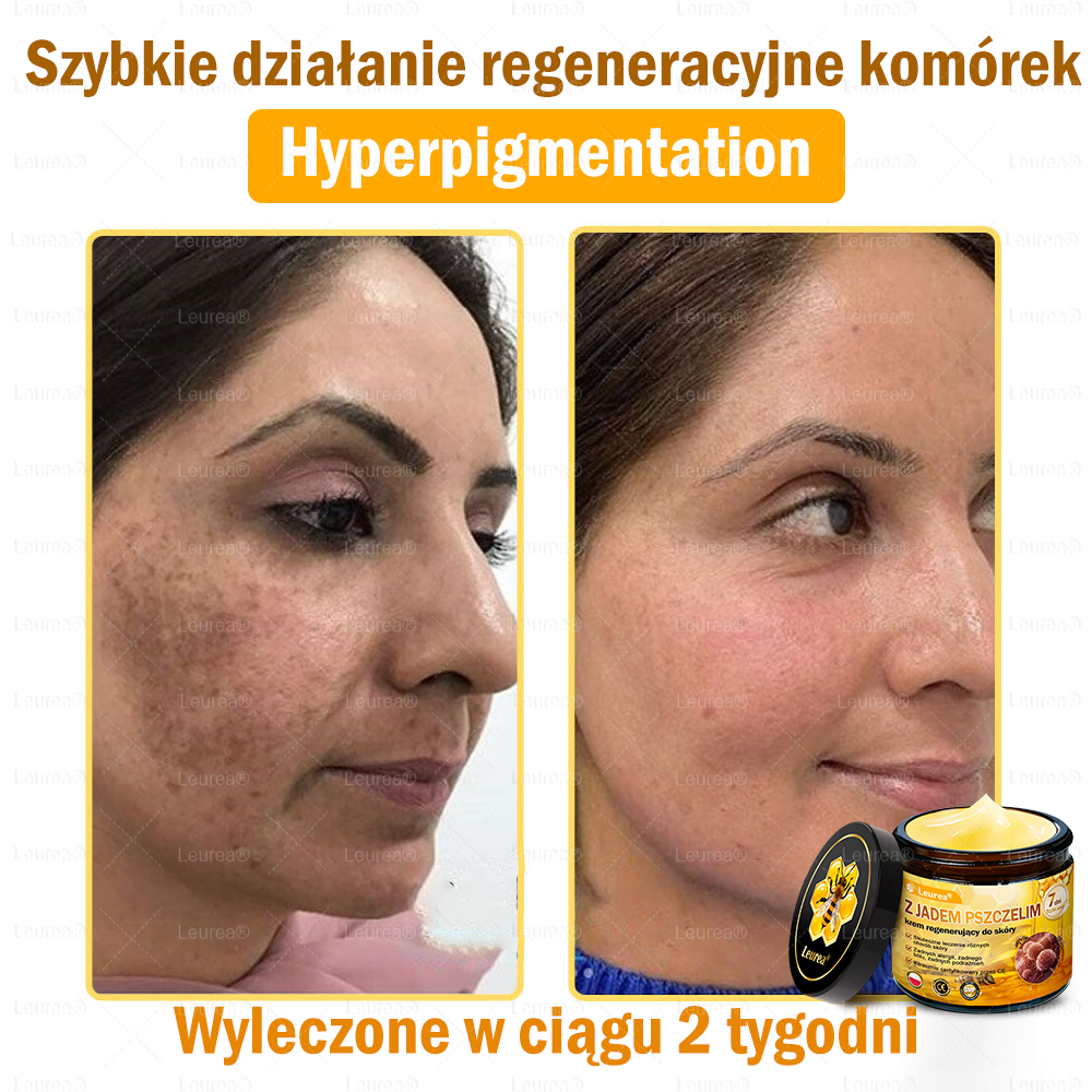 ✨Leurea® Krem Regenerujący z Jadem Pszczelim🔥 Naturalna regeneracja skóry, wygładzenie zmarszczek i promienna cera-50 ml