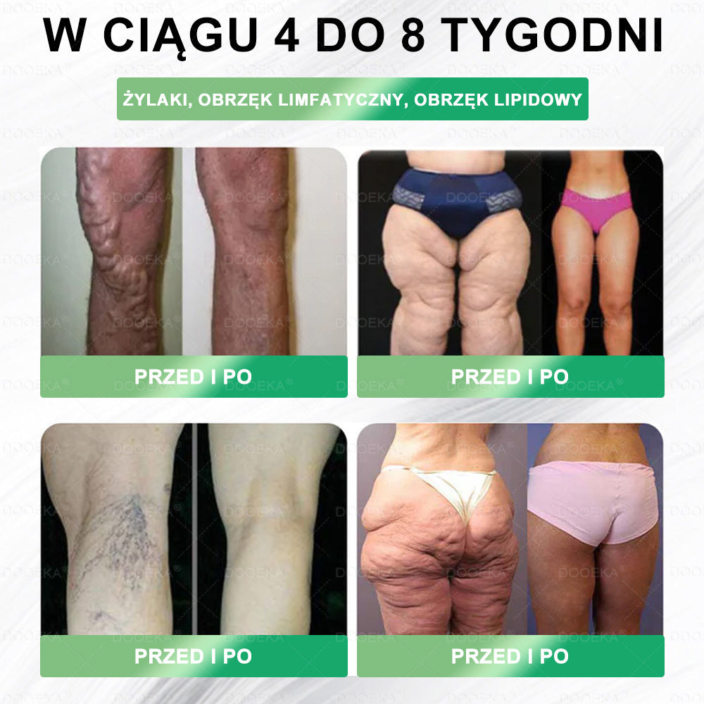 𝑫𝑶𝑶𝑬𝑲𝑨® GLP-1 8 w 1 Fit & Vital roztwór doustny – 🌿 Raz dziennie, widoczne zmiany w ciągu 7 dni / W przypadku otyłości, zdrowia serca i układu krążenia, cukrzycy, bezdechu sennego, zdrowia jelit, problemów ze stawami i wielu innych