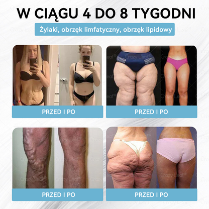 CrazyLeaf® Szczupłość i Witalność Tirzepatide – doustny roztwór wspierający odchudzanie, ciśnienie i poziom cukru