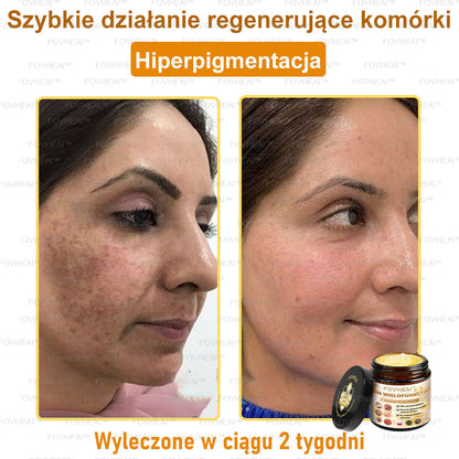 ✨FOVHEAl™ Krem z Jadem Pszczelim – Wygładza zmarszczki i przywraca młody wygląd – 50 ml