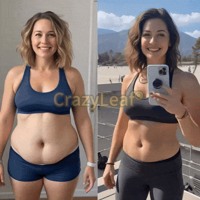 CrazyLeaf® Szczupłość i Witalność Tirzepatide – doustny roztwór wspierający odchudzanie, ciśnienie i poziom cukru